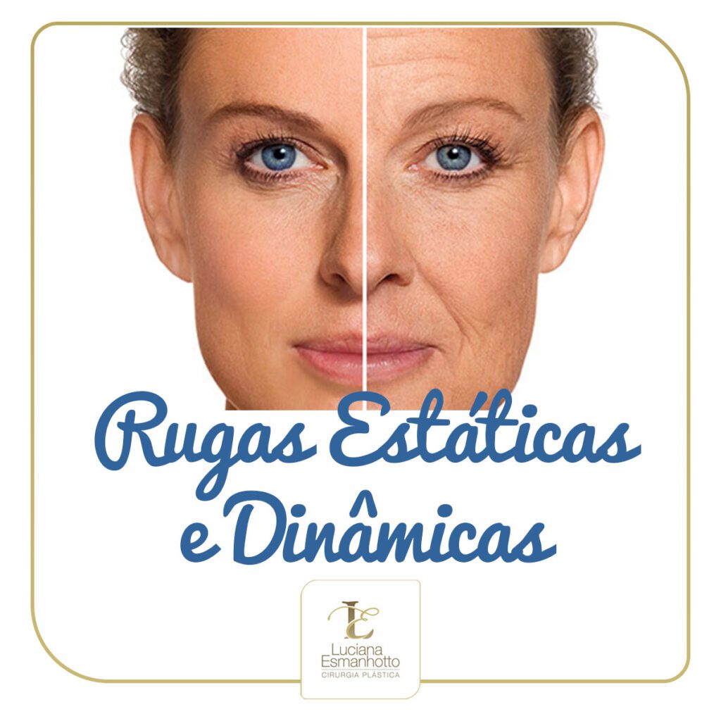 Rugas Estáticas e Dinâmicas - Luciana Esmanhotto