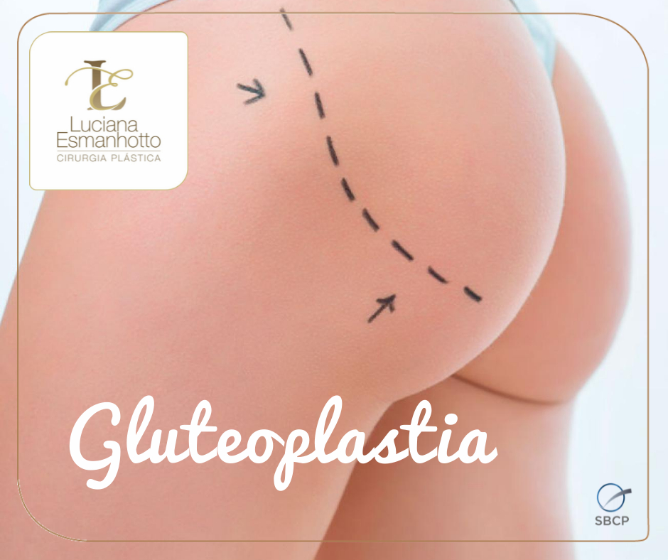 gluteoplastia